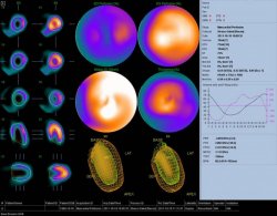 پزشكي هسته اي،chaharfasl.ir