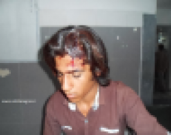 افتادن میله داربست شهرداری بر سر یک جوان +تصاویر